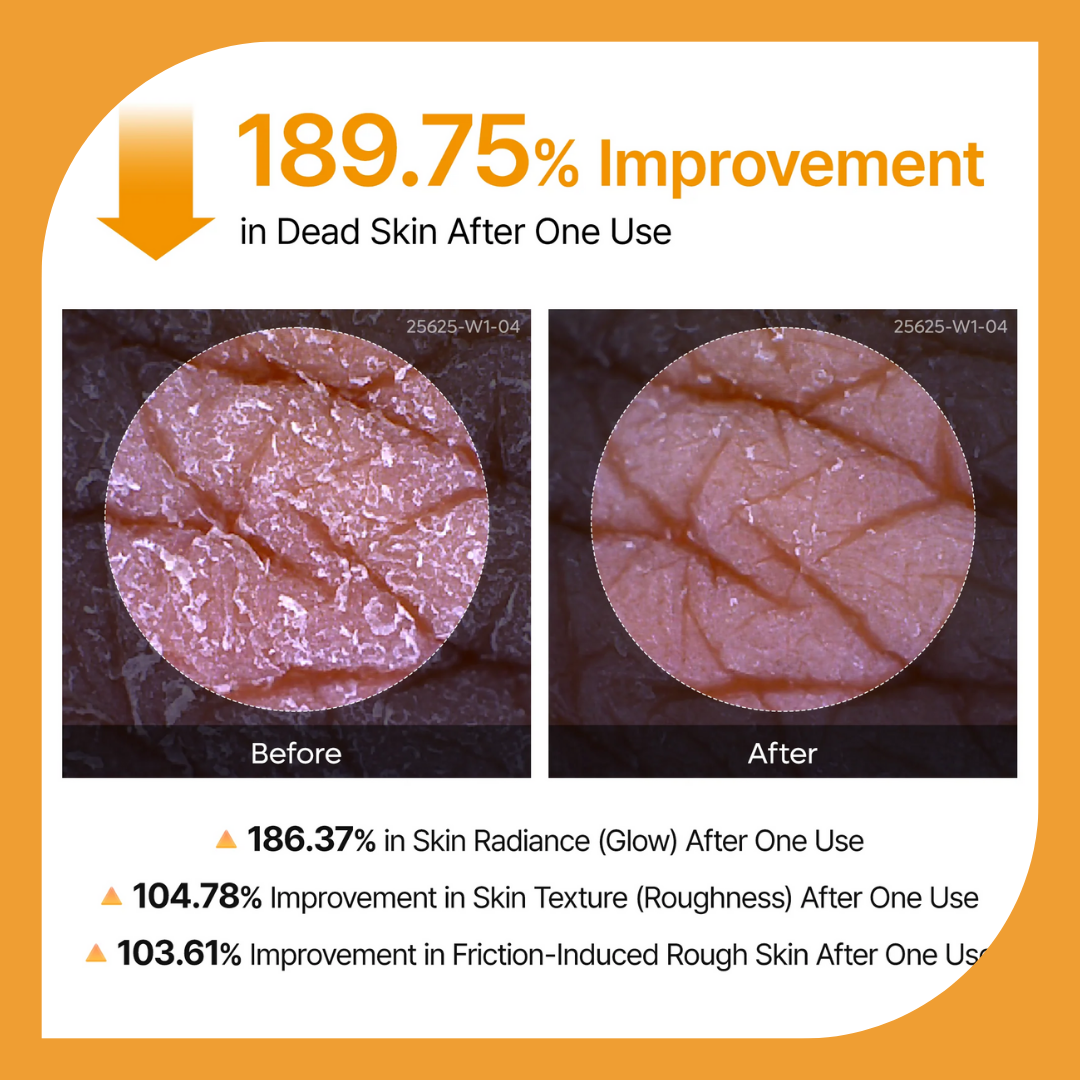 Terre Beauty Peel Shot — Kojic Acid + Turmeric Body Peel Spray